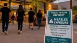 Tempe shoppers warned after measles exposure at Tempe Marketplace